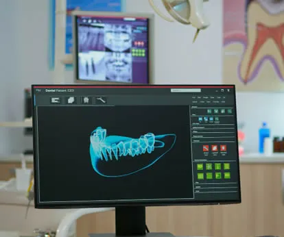 dental implant software computer