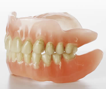 Dental Implants: An Alternative to Dentures and Bridges